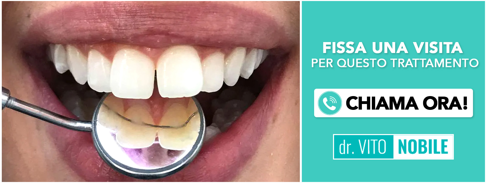 ortodonzia-con-filo-invisibile Taranto